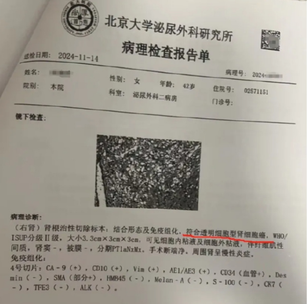 今日股票配资平台 爱康再回应“女子体检十年无异常却患癌”: 病情发展速度极快